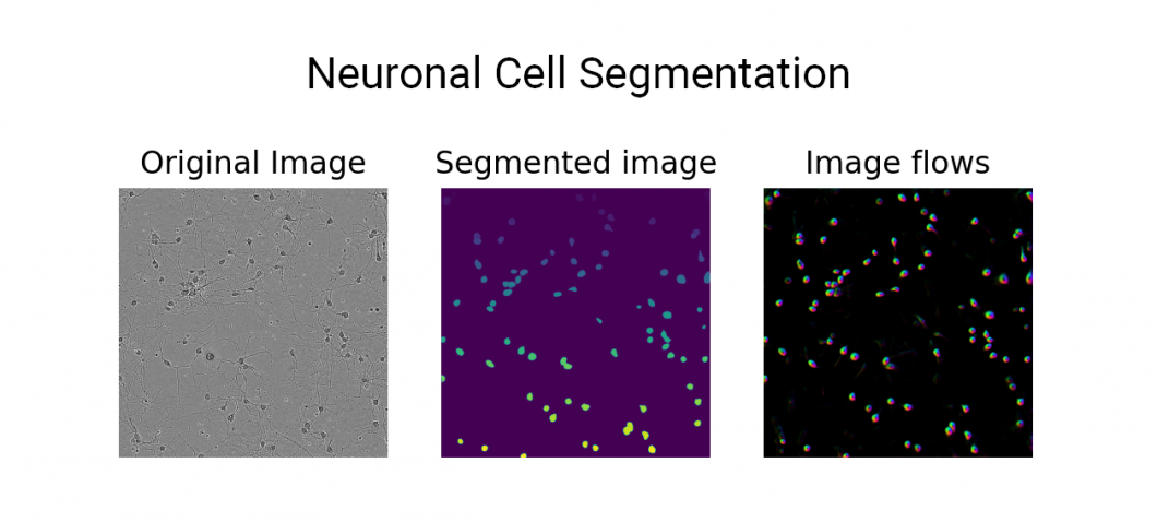 Neuronal cell segmentation model for microscopic analysis