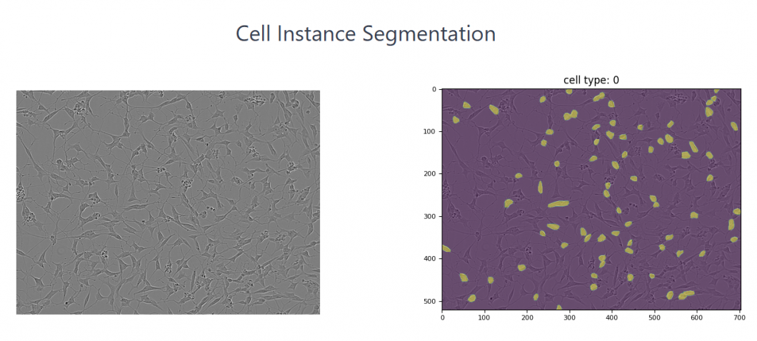 Cell instance segmentation with Computer Vision in healthcare