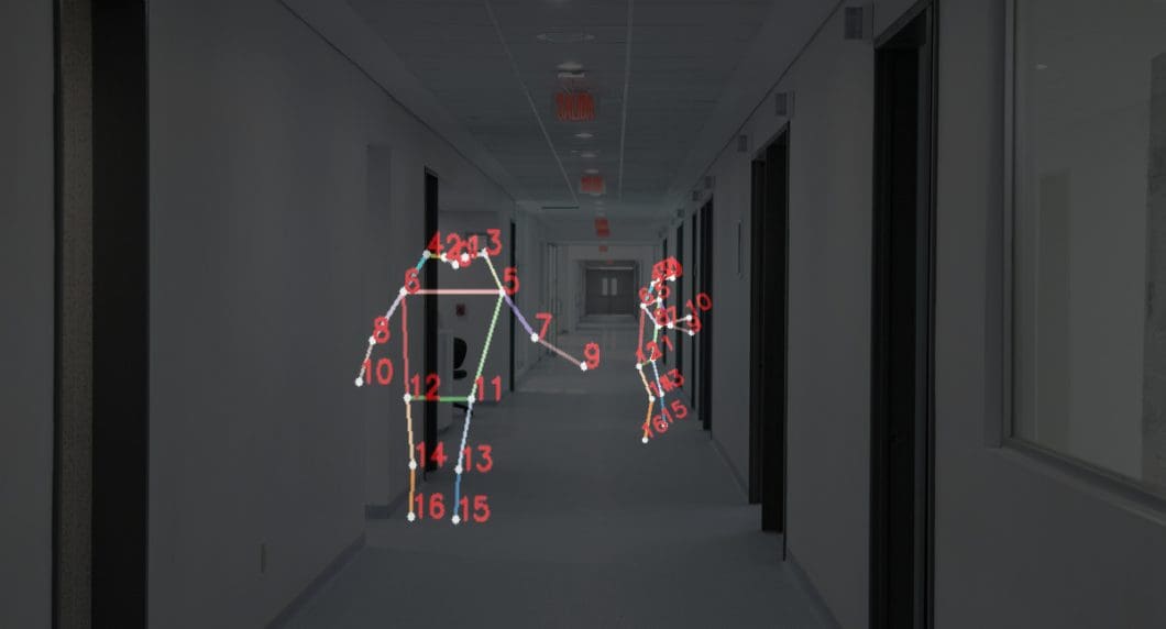 Privacy-preserving Computer Vision in Hospitals