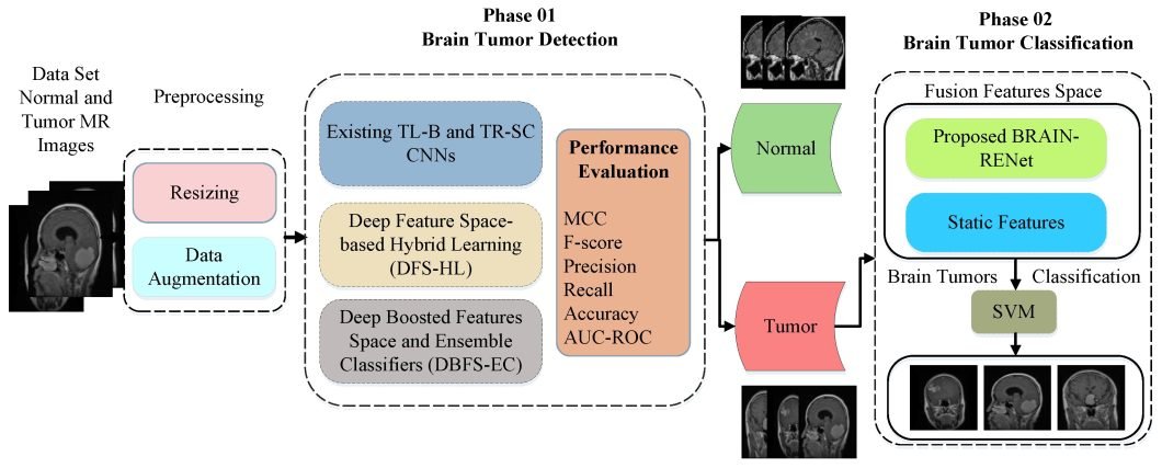 Ensemble Classifiers for Tumor Detection Using MRIs