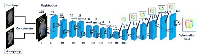 Image Registration Deep Learning