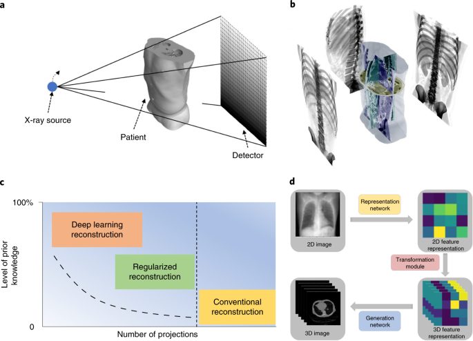 Medical image reconstruction from xray imagery