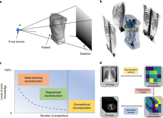 Medical image reconstruction from xray imagery