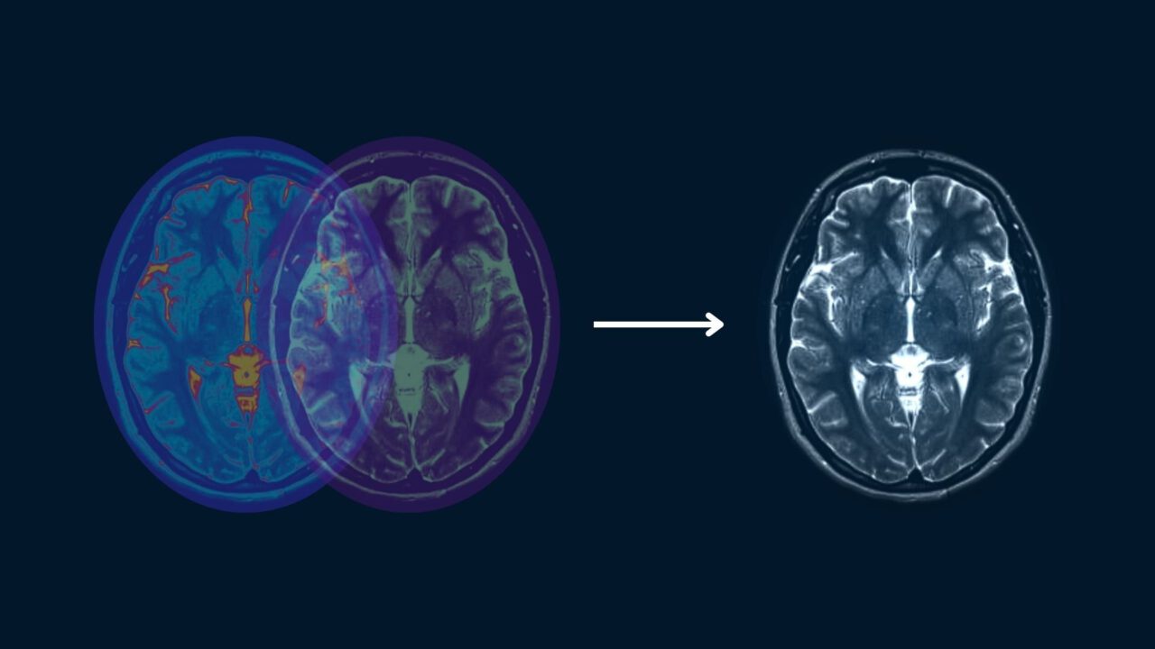 image registration with computer vision