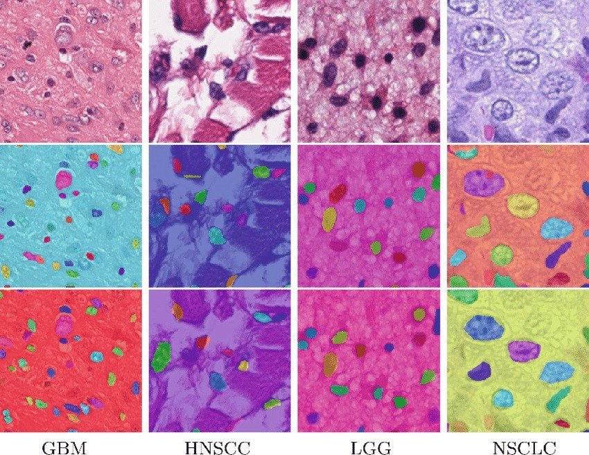 Panoptic-level Cell Segmentation of Various Cancer Categories