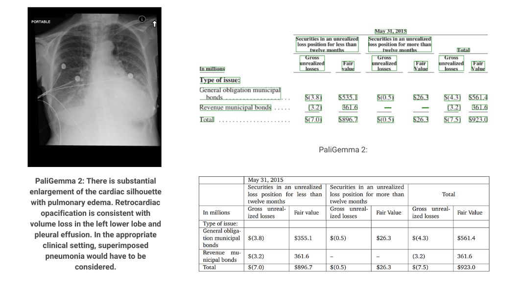 PaliGemma 2 analyzing X-ray images, and tables.